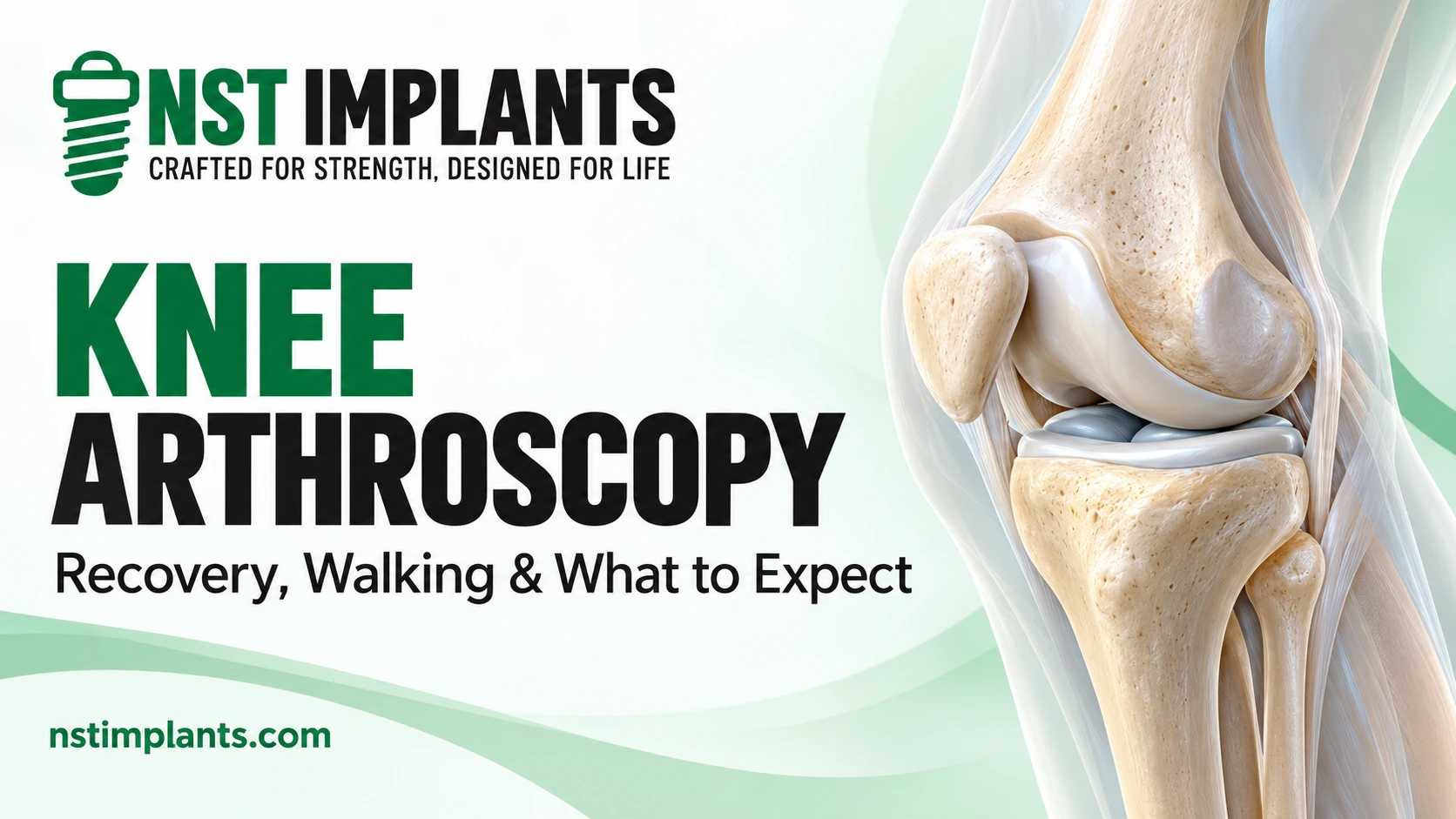 Knee arthroscopy recovery time guide featuring a knee joint illustration and NST Implants